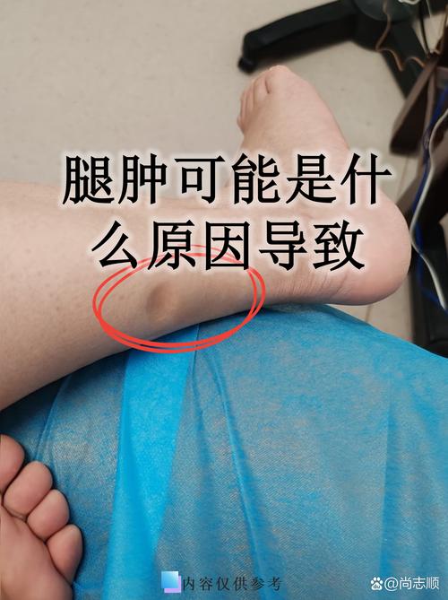 女明星大腿松弛原因揭秘，高强度工作与健康饮食如何平衡
